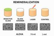 The Effect of the Bioactive Glass and the Er:YAG Laser on the Remineralization of the Affected Dentin: A Comparative In Vitro Study