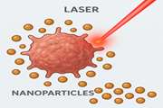 The Combination of Laser Therapy and Metal Nanoparticles in Cancer Treatment Originated From Epithelial Tissues: A Literature Review