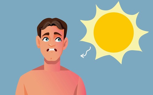 چگونه اشعه‌ خورشید سلامت و زیبایی پوست شما را تغییر می‌دهد؟